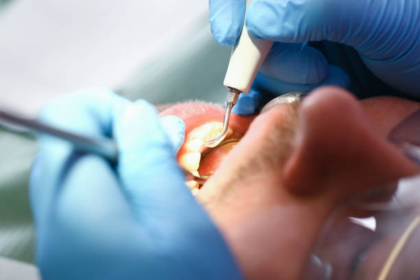 Best Teeth Whitening  in Andover, MN